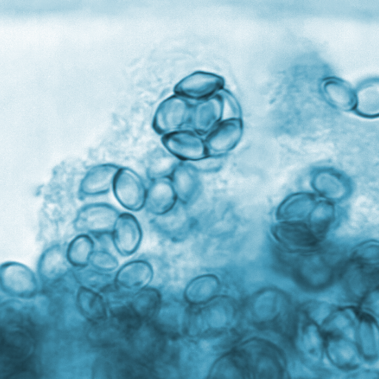 Todo sobre Saccharomyces Boulardii, un probiótico de gran potencial 6 saccharomyces_boulardii_probiótico