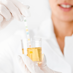 orina-cambia-de-color