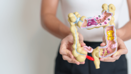 ¿Qué es un Trastorno Funcional Intestinal? 9 ¿Qué es un Trastorno Funcional Intestinal? 9