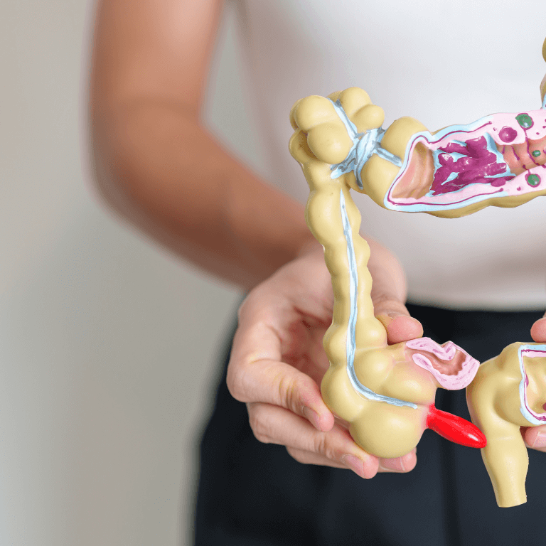 ¿Qué es un Trastorno Funcional Intestinal? 7 ¿Qué es un Trastorno Funcional Intestinal? 7