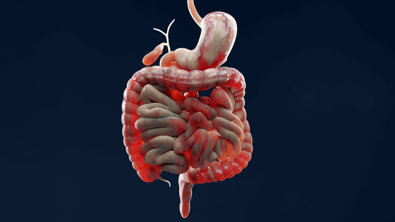 ¿Qué es un Trastorno Funcional Intestinal? 1