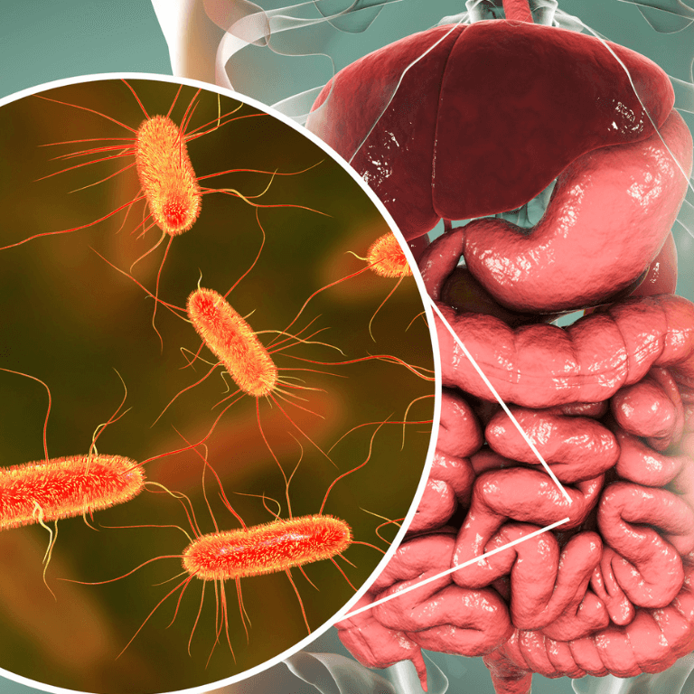 4 Consejos para cuidar la microbiota intestinal 4 4 Consejos para cuidar la microbiota intestinal 4