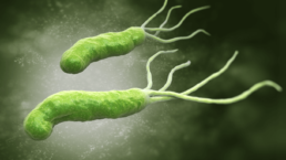 Helicobacter Pylori: Síntomas y Cómo Mejorar tu Salud Digestiva 4 Helicobacter Pylori: Síntomas y Cómo Mejorar tu Salud Digestiva 4